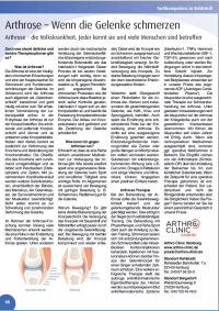 Artikel zum Thema Arthrose – Wenn die Gelenke schmerzen